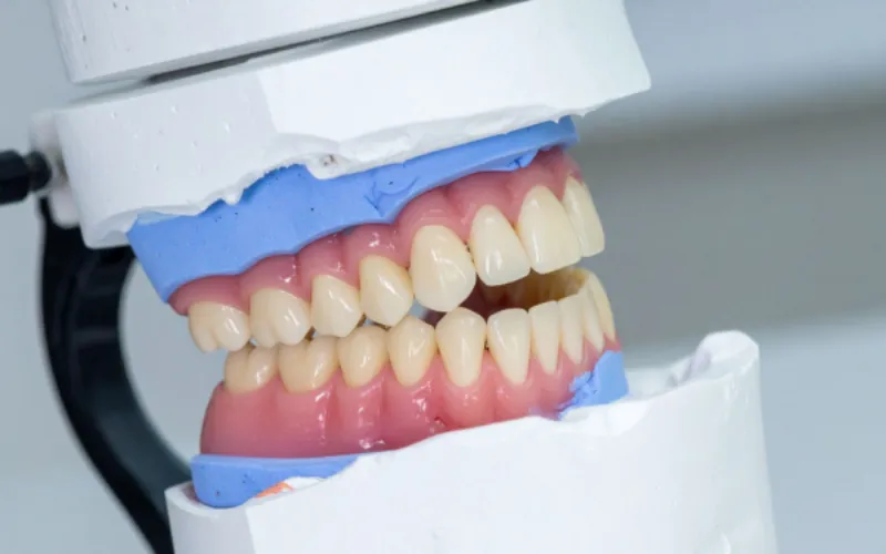 full partial dentures