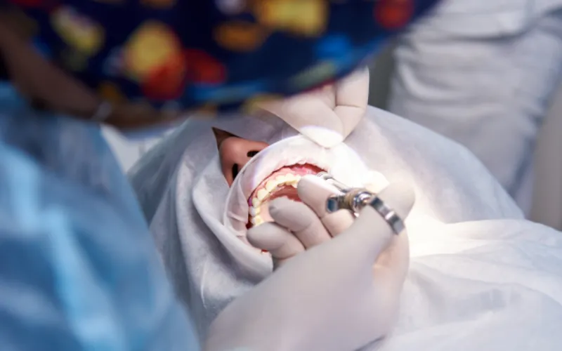 oral surgery (1)