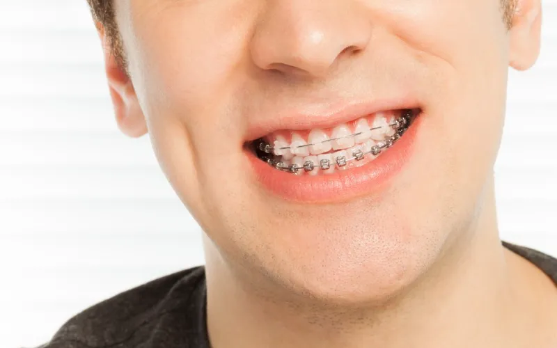 orthodontics (1)