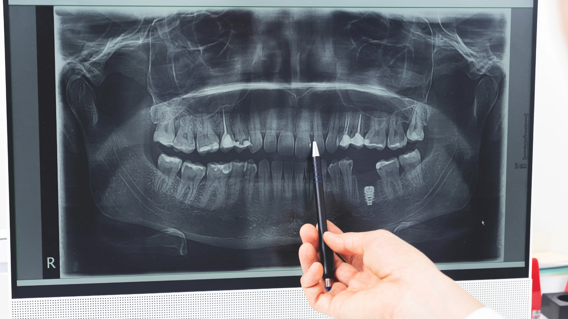 dental xray in dallas