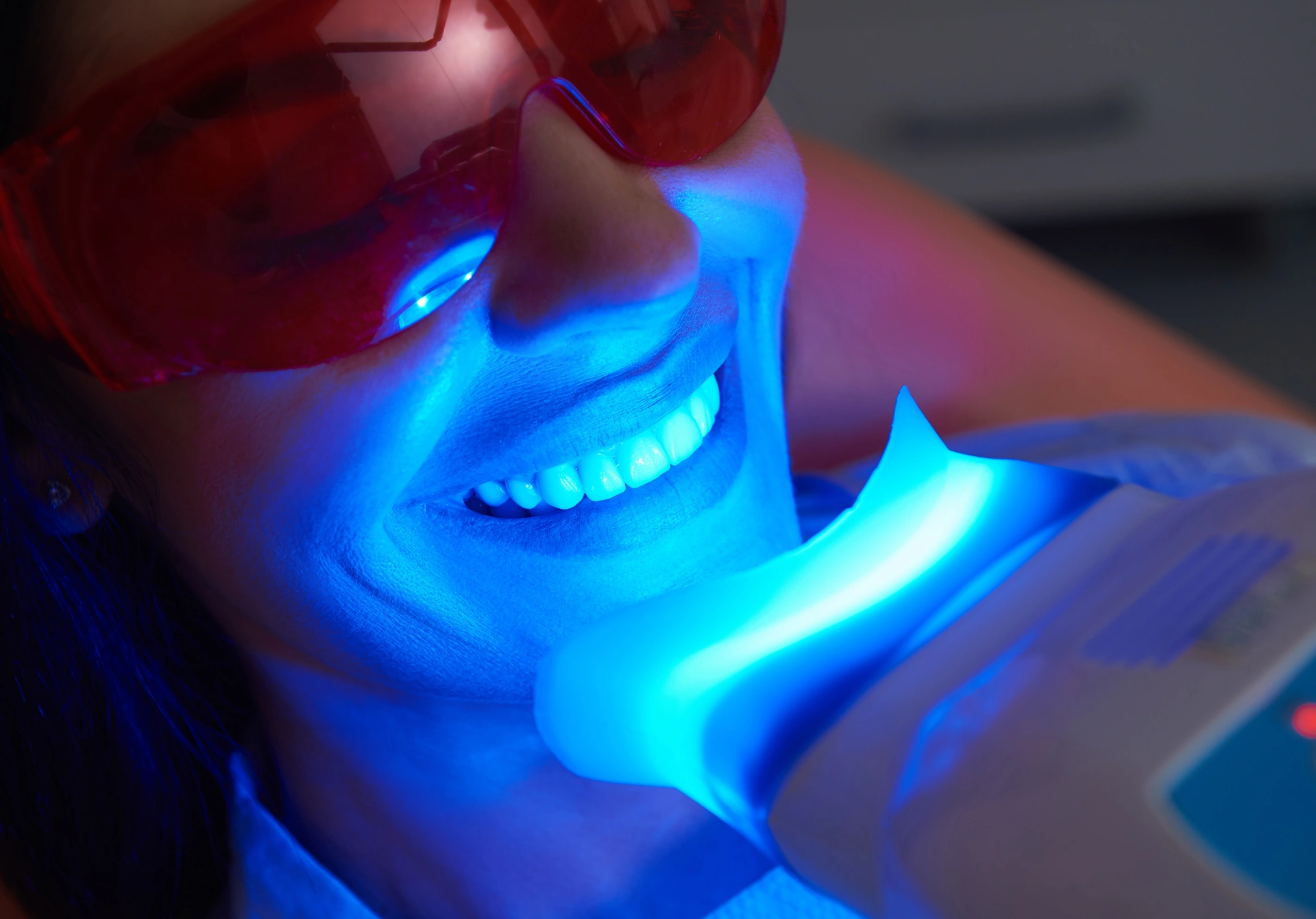teeth whitening