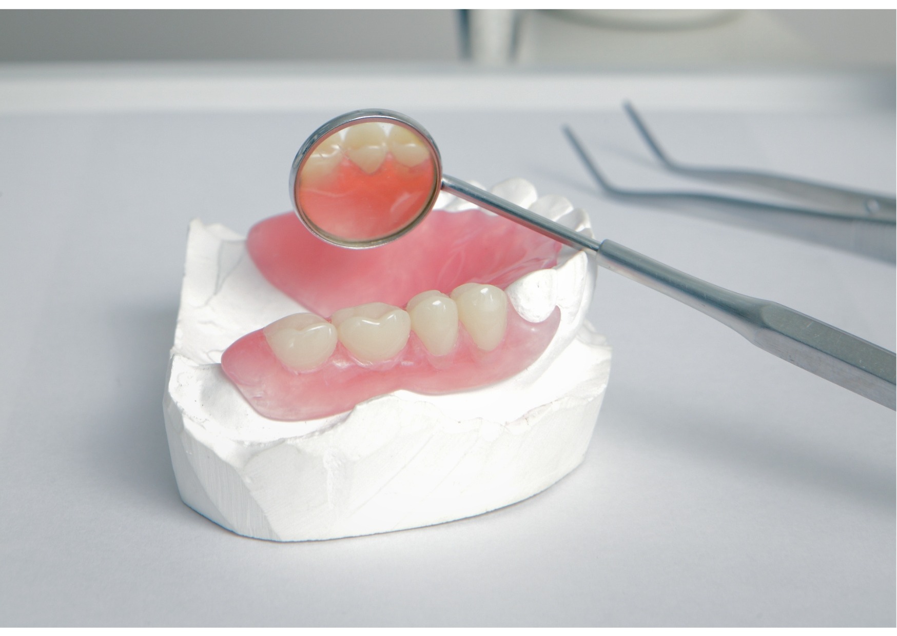 Dental restoration model and mirror used to explain differences between bonding and veneers treatments