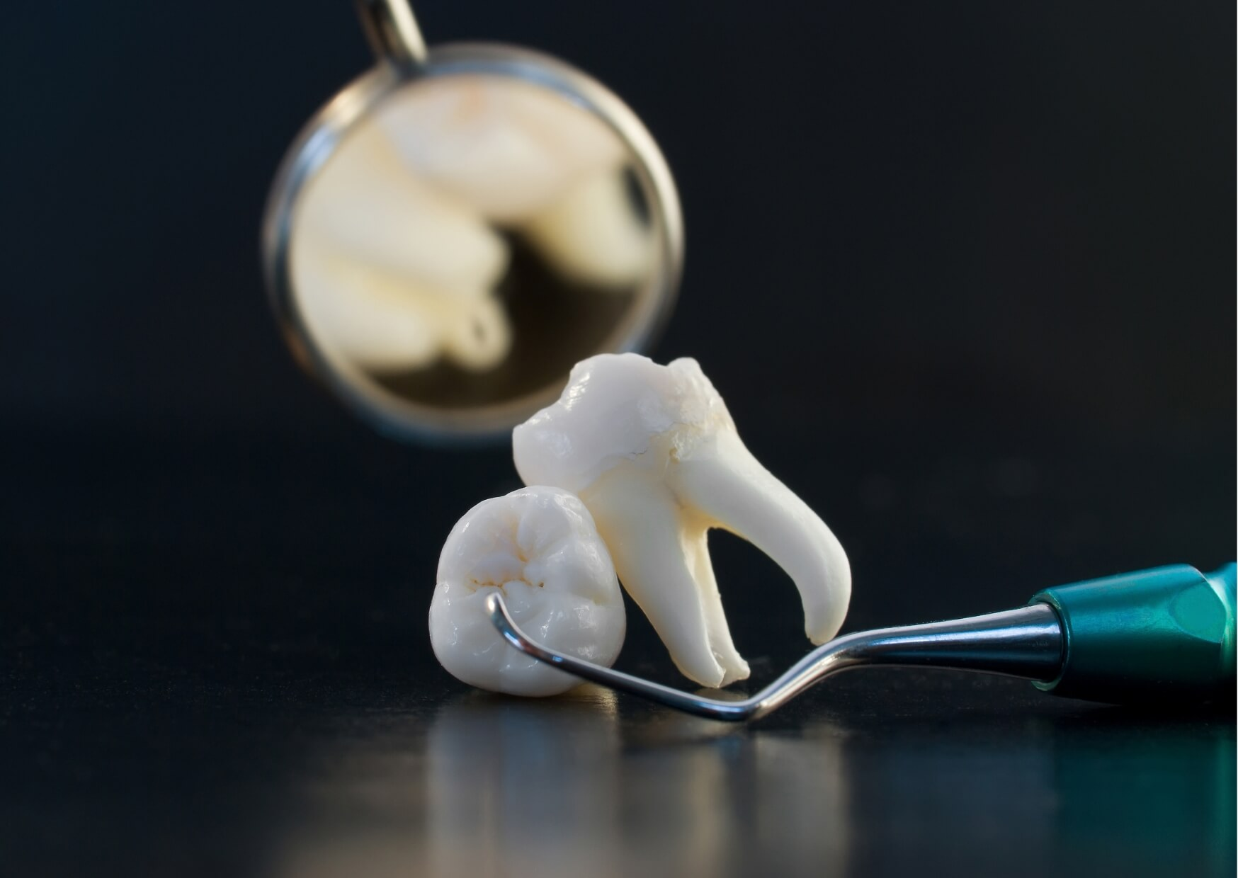 Wisdom tooth model displayed beside a dental mirror and explorer, illustrating the development and eruption process of wisdom teeth as they emerge in the late teens or early adulthood.
