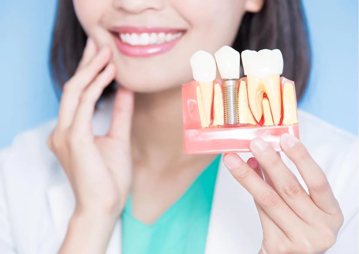 Dental implant model illustrating factors related to how long dental implants last.