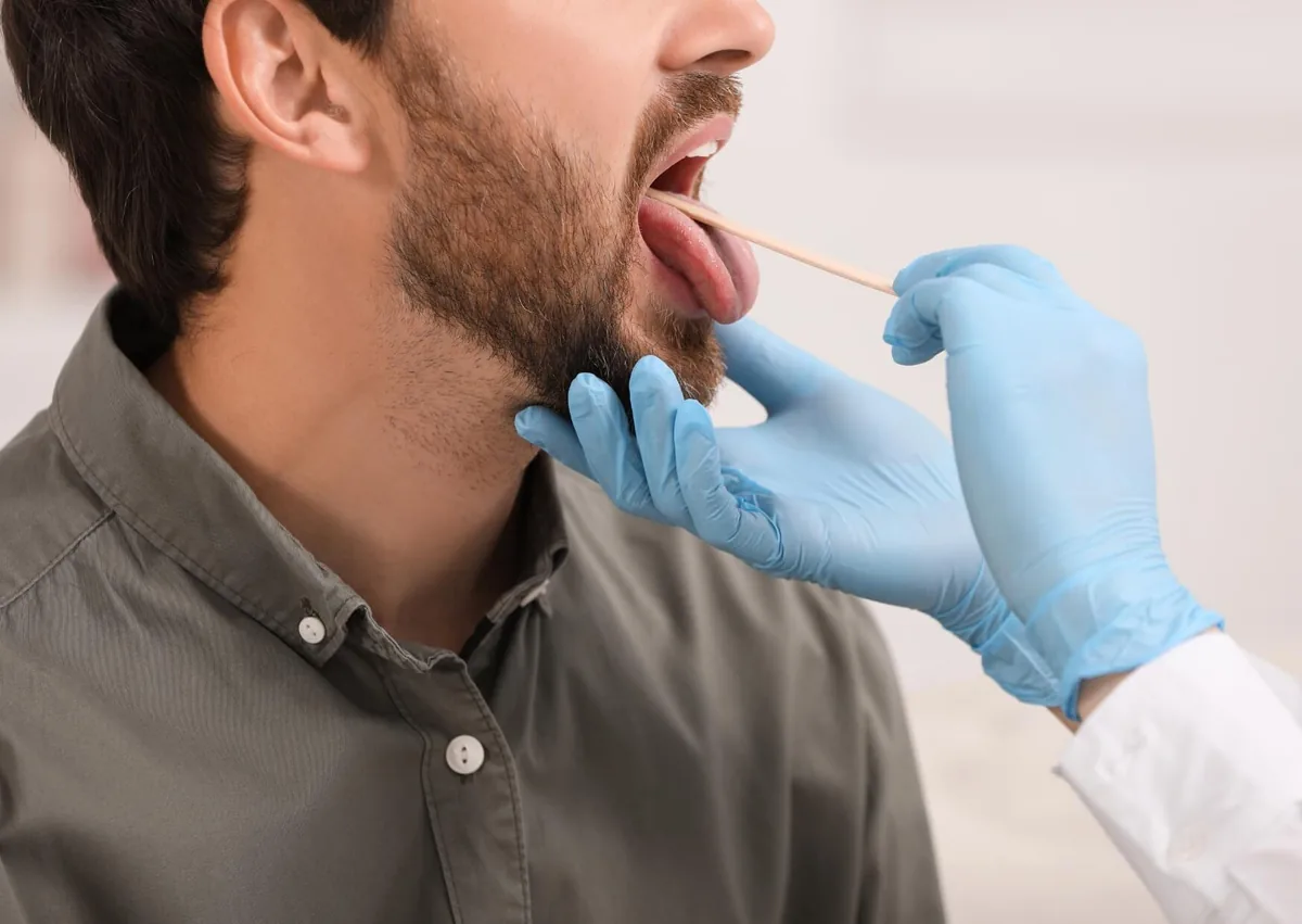Healthcare professional examining a patient’s tongue for symptoms of oral thrush.